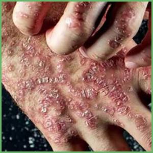 All you need to know about autoimmune disorders